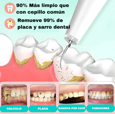 Removedor de Sarro.