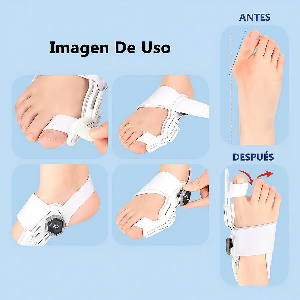 Corrector De Juanetes