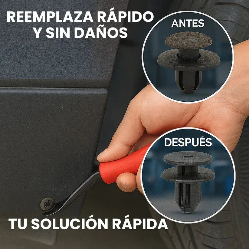 Kit de Clips o Grapas para Automovil