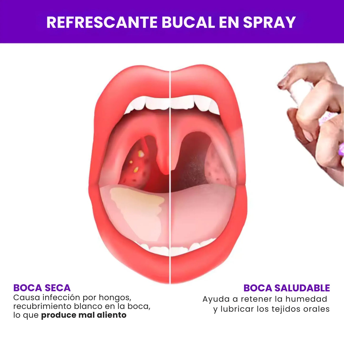 Spray para el mal aliento