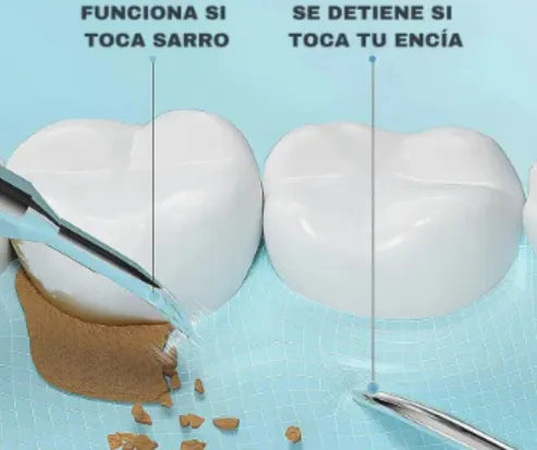 Removedor de Sarro