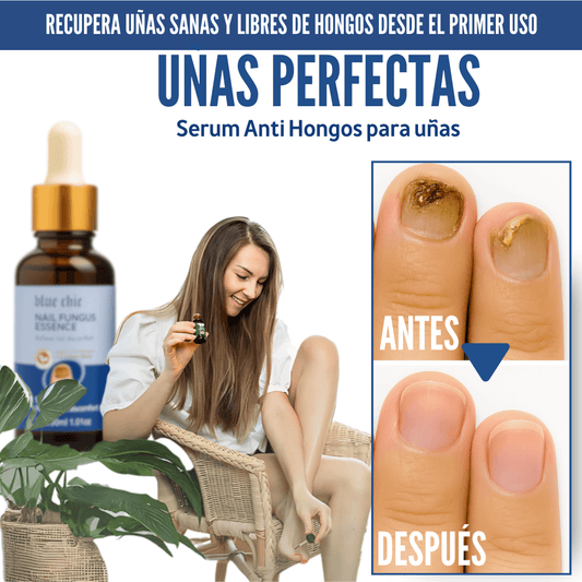 Serum para Uñas AntiHongos