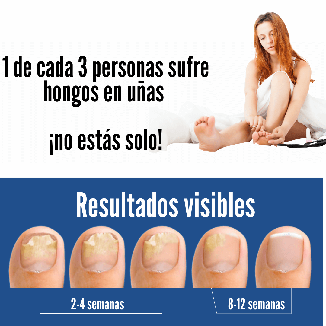 Serum para Uñas AntiHongos