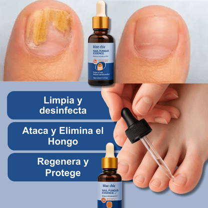 Serum para Uñas AntiHongos