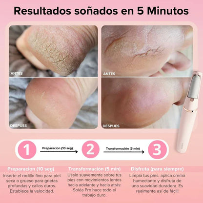 Removedor de Callos